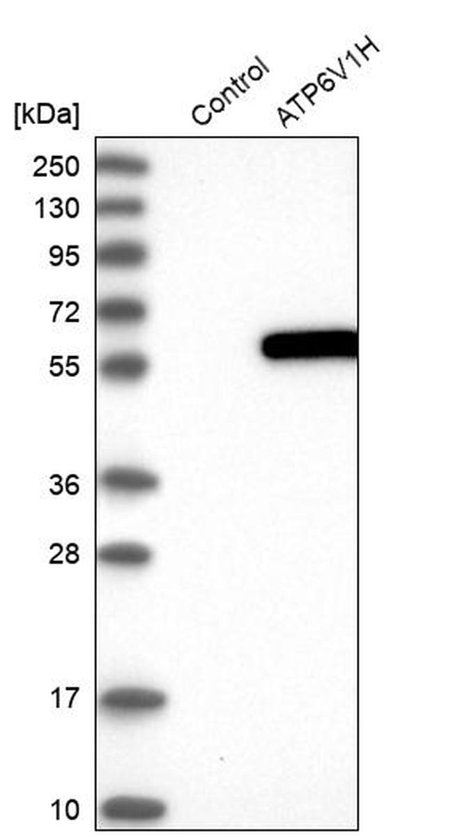 V-ATPase H Antibody in Western Blot (WB)