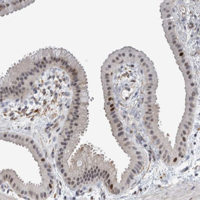 MSL1 Antibody in Immunohistochemistry (IHC)