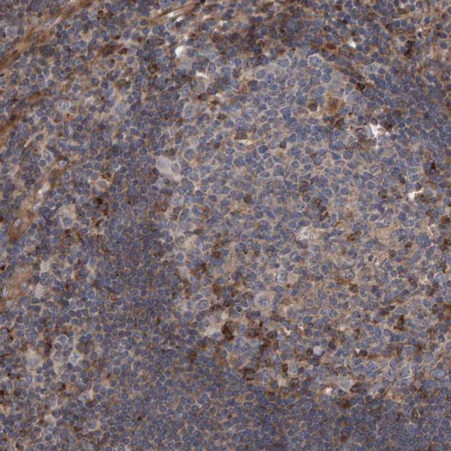 LRBA Antibody in Immunohistochemistry (IHC)