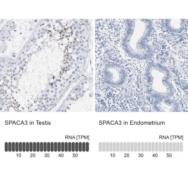 SPACA3 Antibody