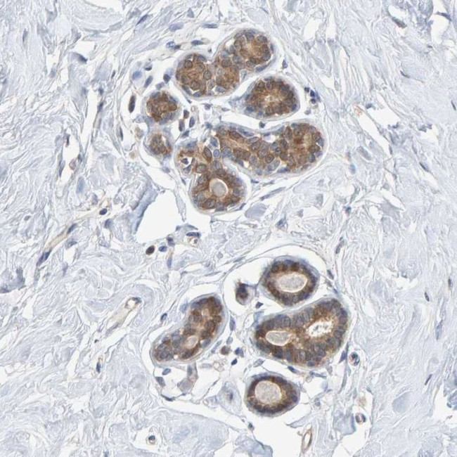 TATDN1 Antibody in Immunohistochemistry (IHC)