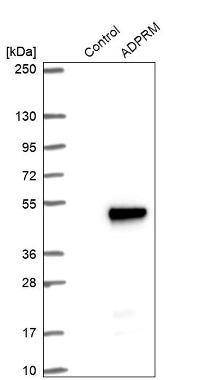 ADPRM Antibody in Western Blot (WB)