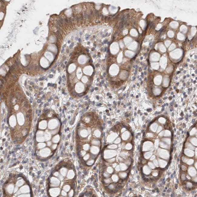 GSDMB Antibody in Immunohistochemistry (Paraffin) (IHC (P))