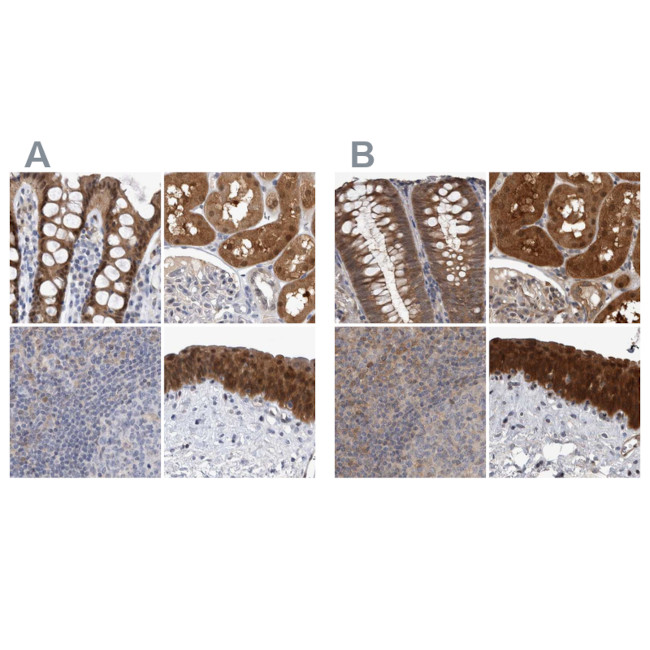 NAPRT1 Antibody in Immunohistochemistry (IHC)