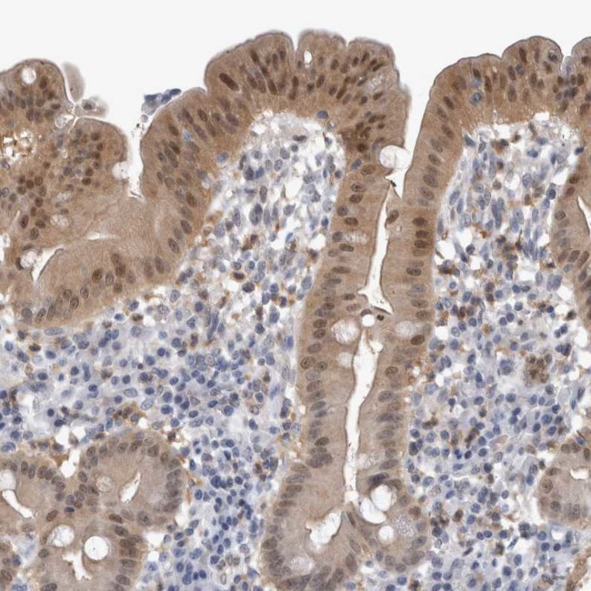 NAPRT1 Antibody in Immunohistochemistry (IHC)