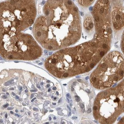 NAPRT1 Antibody in Immunohistochemistry (IHC)