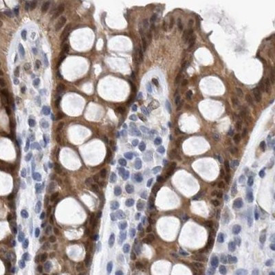 NAPRT1 Antibody in Immunohistochemistry (IHC)