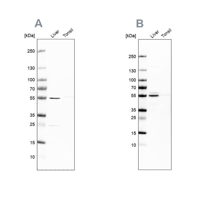 NAPRT1 Antibody in Western Blot (WB)