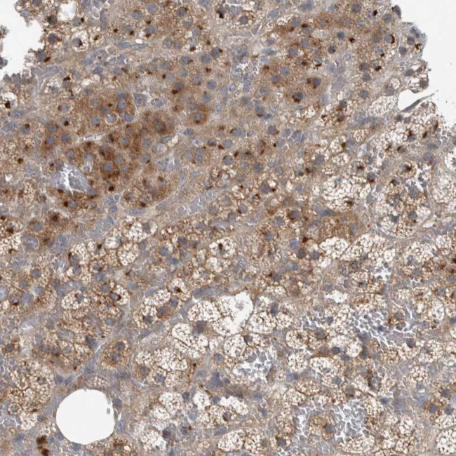 CLCN2 Antibody in Immunohistochemistry (Paraffin) (IHC (P))