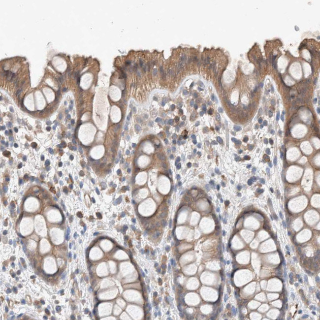 UGCG Antibody in Immunohistochemistry (IHC)