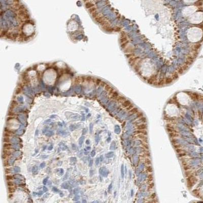 HDHD3 Antibody in Immunohistochemistry (IHC)