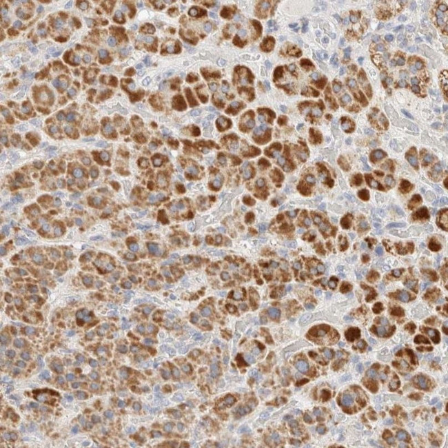 HDHD3 Antibody in Immunohistochemistry (IHC)