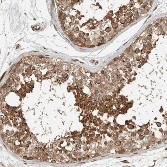 Synip Antibody in Immunohistochemistry (IHC)