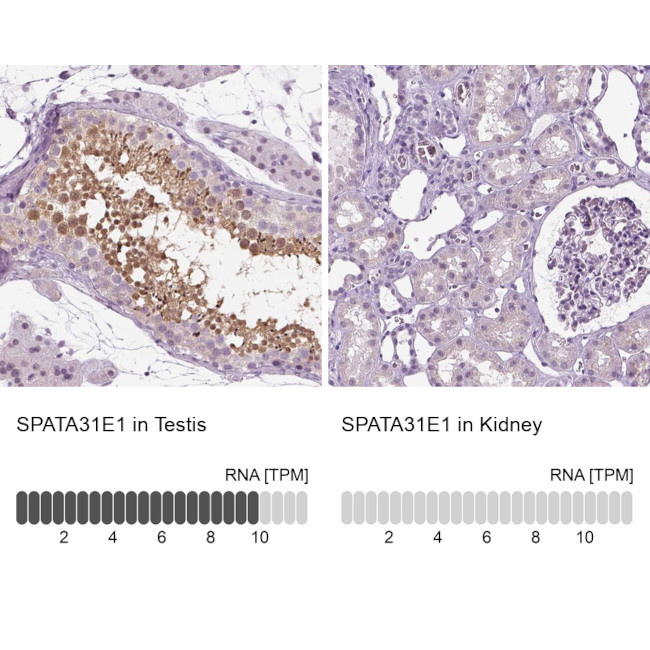 SPATA31E1 Antibody in Immunohistochemistry (IHC)