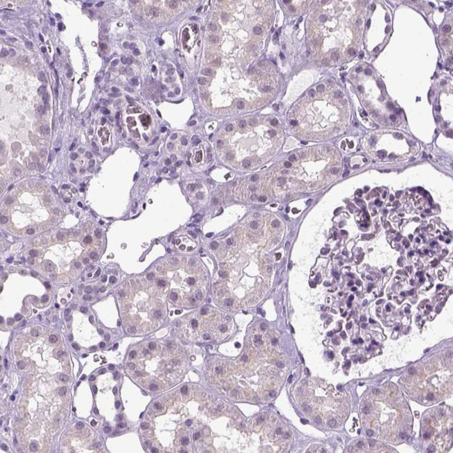 SPATA31E1 Antibody in Immunohistochemistry (IHC)