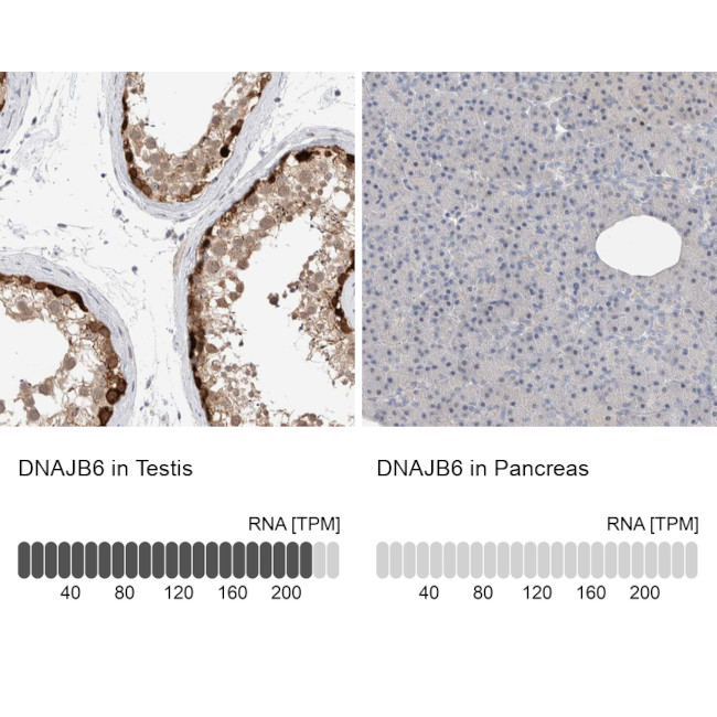 DNAJB6 Antibody in Immunohistochemistry (IHC)