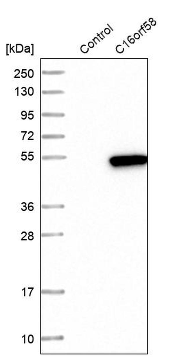 C16orf58 Antibody in Western Blot (WB)