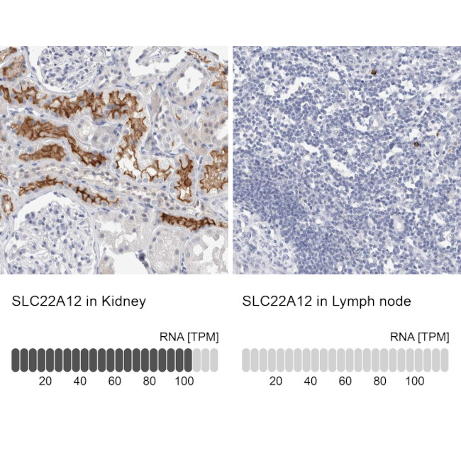SLC22A12 Antibody in Immunohistochemistry (IHC)