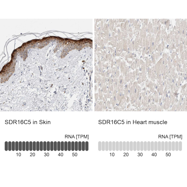 SDR16C5 Antibody in Immunohistochemistry (IHC)