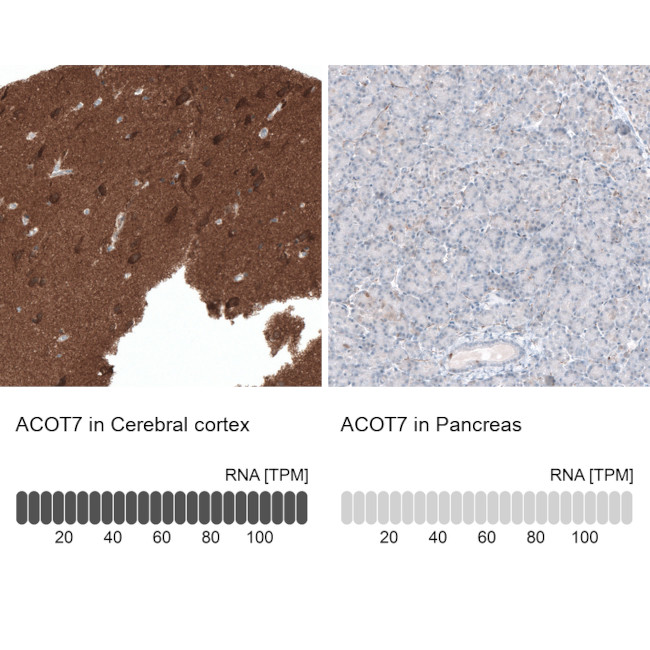 ACOT7 Antibody in Immunohistochemistry (IHC)