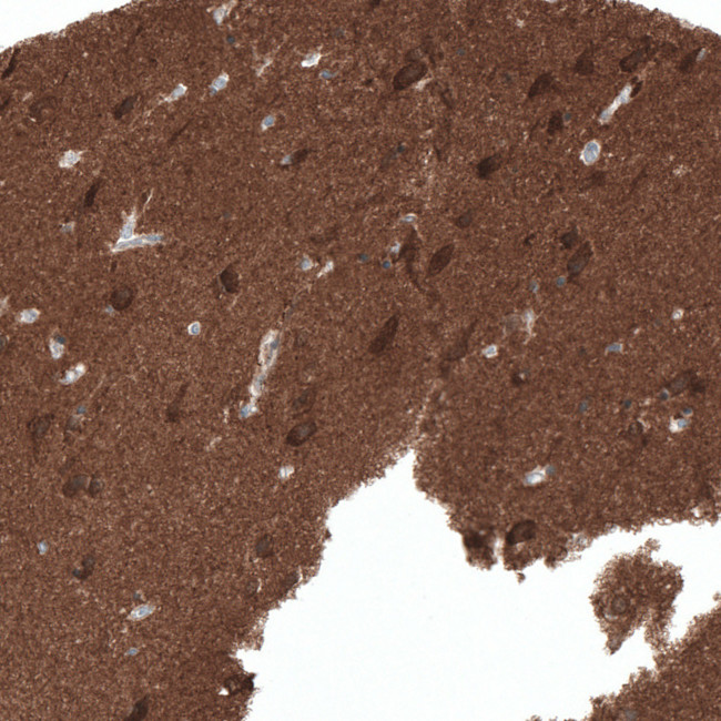 ACOT7 Antibody in Immunohistochemistry (IHC)