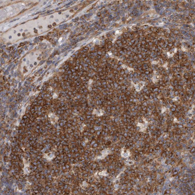 PEX6 Antibody in Immunohistochemistry (IHC)