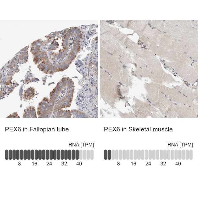 PEX6 Antibody