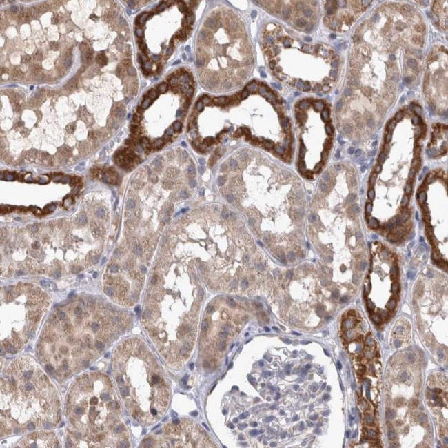 DBT Antibody in Immunohistochemistry (IHC)