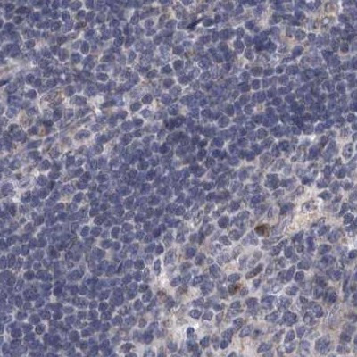 DBT Antibody in Immunohistochemistry (IHC)