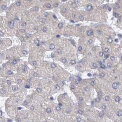 DBT Antibody in Immunohistochemistry (IHC)