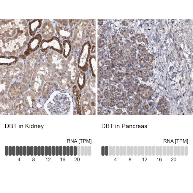 DBT Antibody