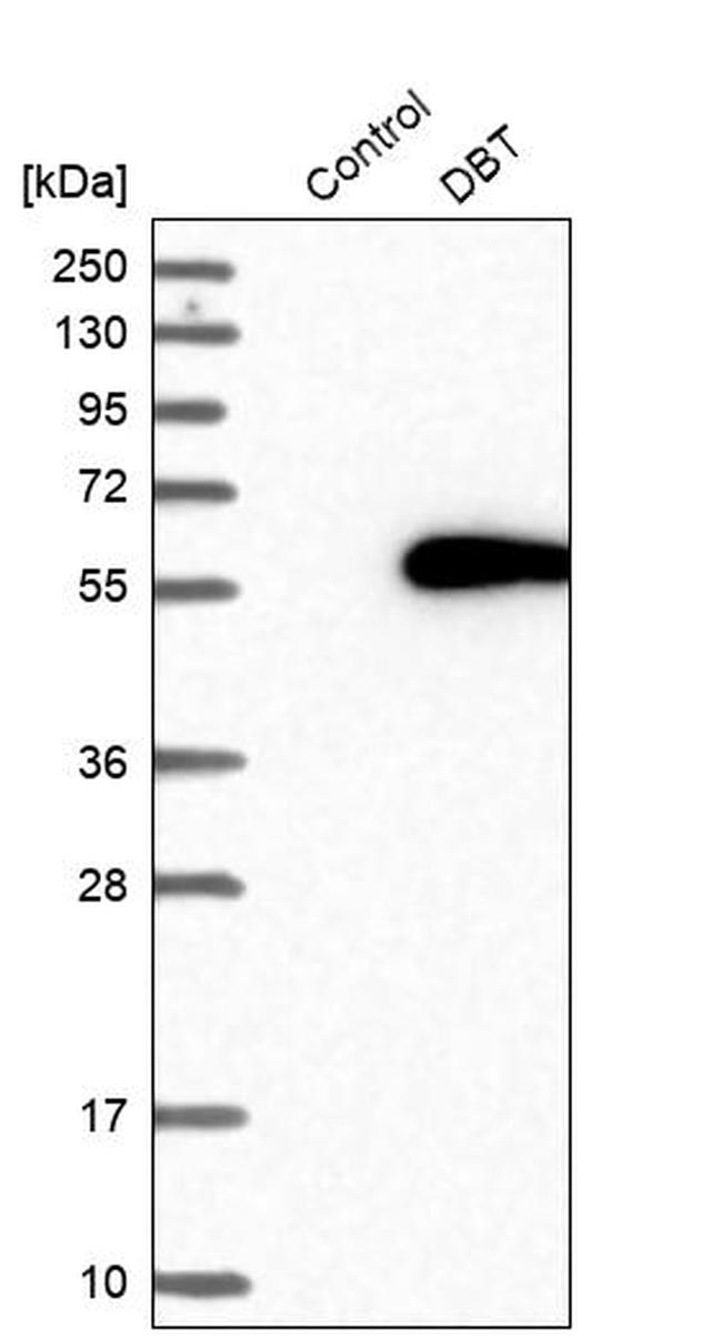 DBT Antibody in Western Blot (WB)