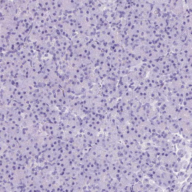 NTS Antibody in Immunohistochemistry (IHC)