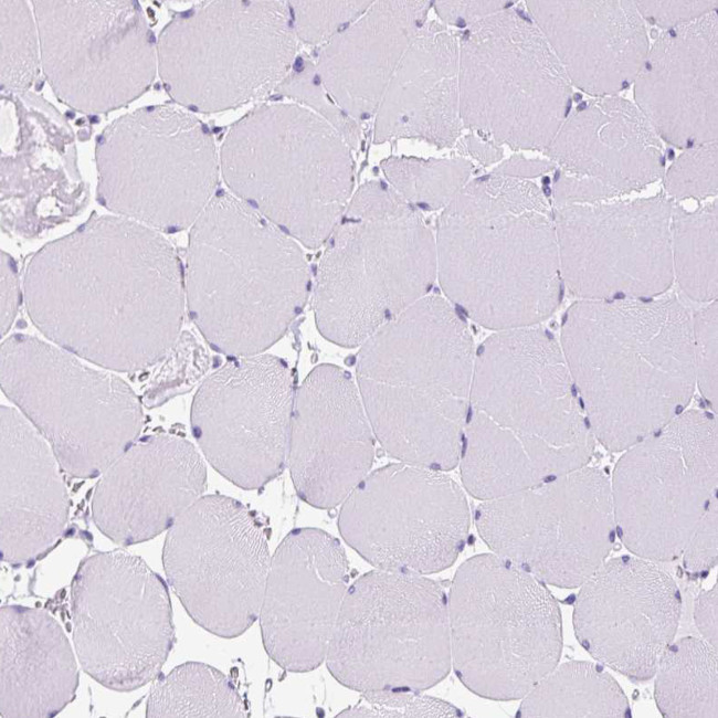 NTS Antibody in Immunohistochemistry (IHC)