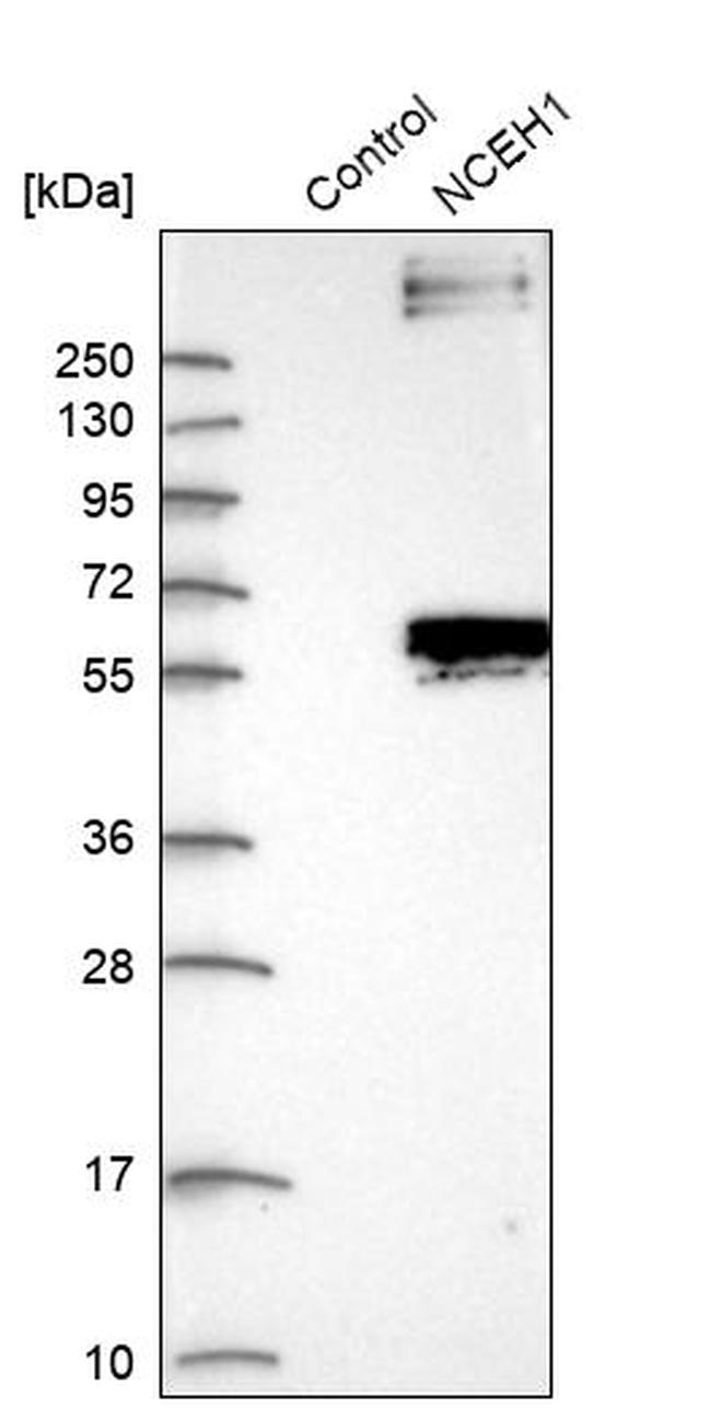 NCEH1 Antibody in Western Blot (WB)