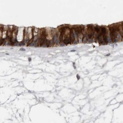 UFC1 Antibody in Immunohistochemistry (IHC)