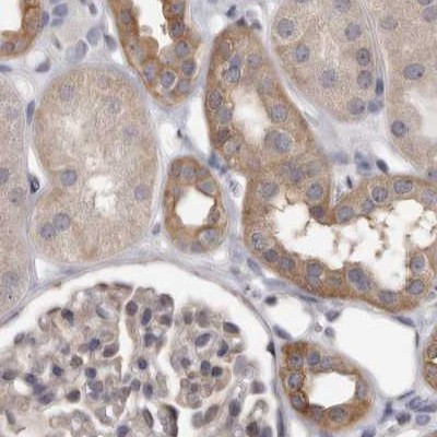 UFC1 Antibody in Immunohistochemistry (IHC)