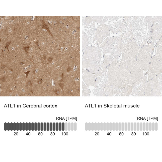 ATL1 Antibody in Immunohistochemistry (IHC)