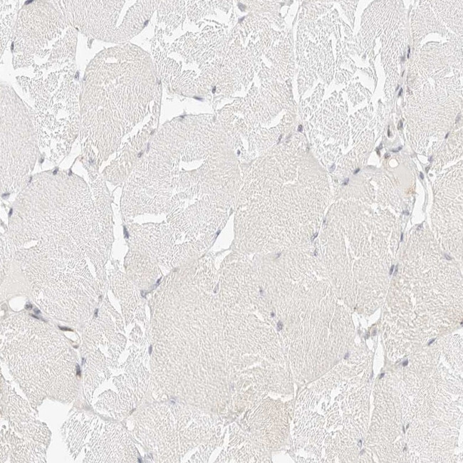 ATL1 Antibody in Immunohistochemistry (IHC)