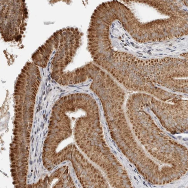 PEX2 Antibody in Immunohistochemistry (IHC)