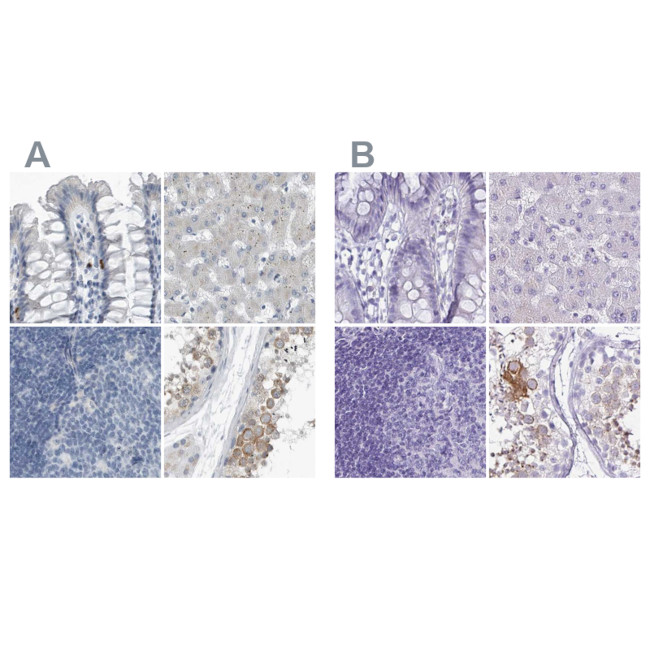 ZPBP2 Antibody in Immunohistochemistry (IHC)