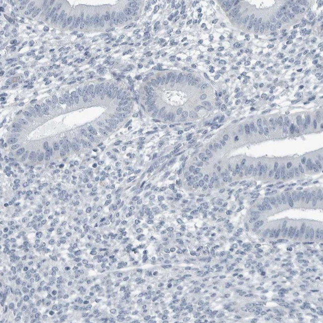 ZPBP2 Antibody in Immunohistochemistry (IHC)