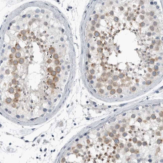 ZPBP2 Antibody in Immunohistochemistry (IHC)