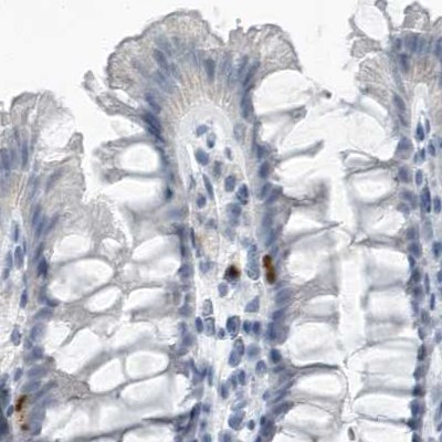 ZPBP2 Antibody in Immunohistochemistry (IHC)