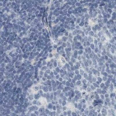 ZPBP2 Antibody in Immunohistochemistry (IHC)