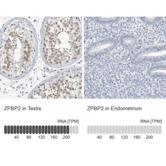 ZPBP2 Antibody