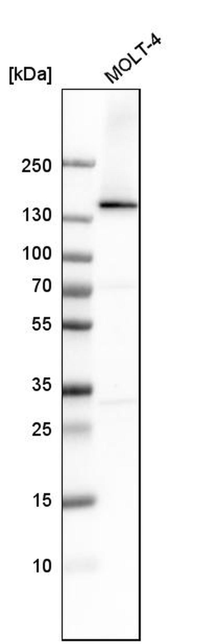 DHX9 Antibody in Western Blot (WB)