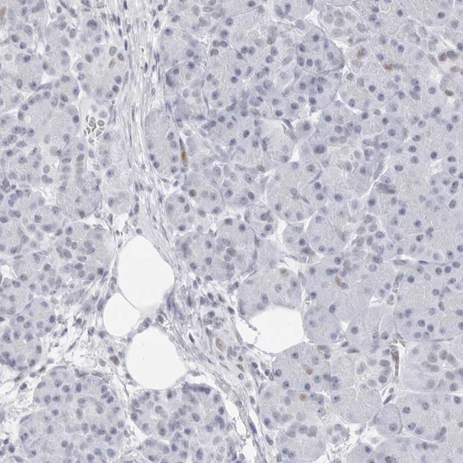 NASP Antibody in Immunohistochemistry (IHC)