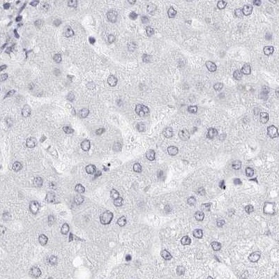 NASP Antibody in Immunohistochemistry (IHC)