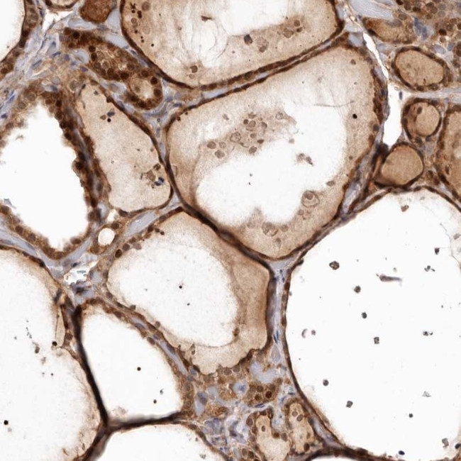 GPATCH4 Antibody in Immunohistochemistry (Paraffin) (IHC (P))